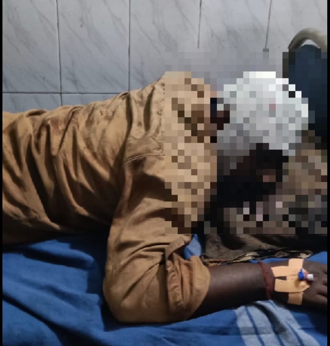 फर्नेस ब्लास्ट में तीन कर्मी झुलसे,एक की हालत गंभीर, पहले भी हो चुके हैं जानलेवा हादसे