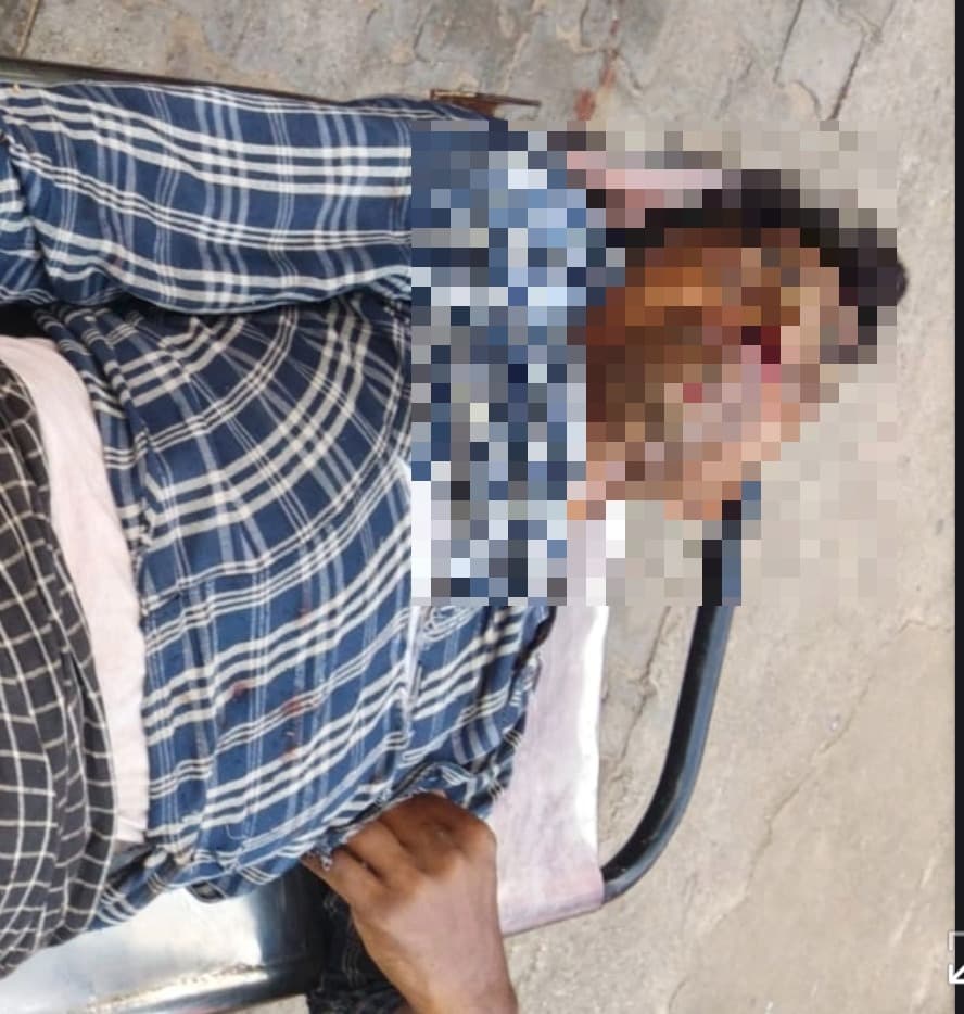 हाइवा की चपेट में आकर बाइक सवार युवक गंभीर रूप से घायल, रेफर 