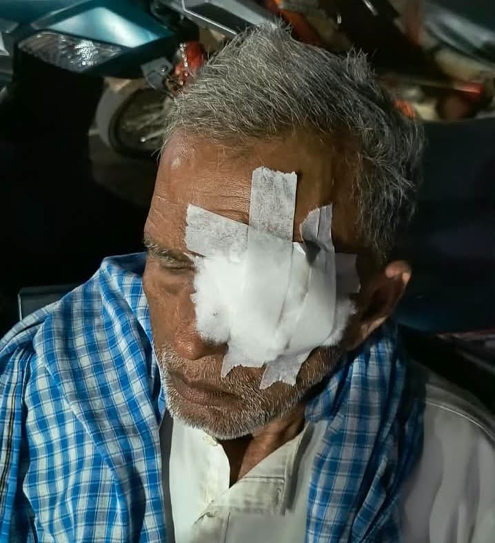 महिला से छेड़छाड़ का विरोध पड़ा भारी! पति की बेरहमी से पिटाई, आंख में गंभीर चोट; रांची रेफर