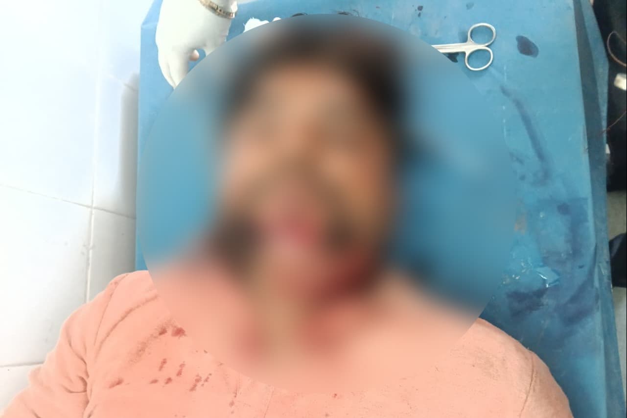 सड़क किनारे डिवाइडर से टकराई बाइक, युवक गंभीर रूप से घायल