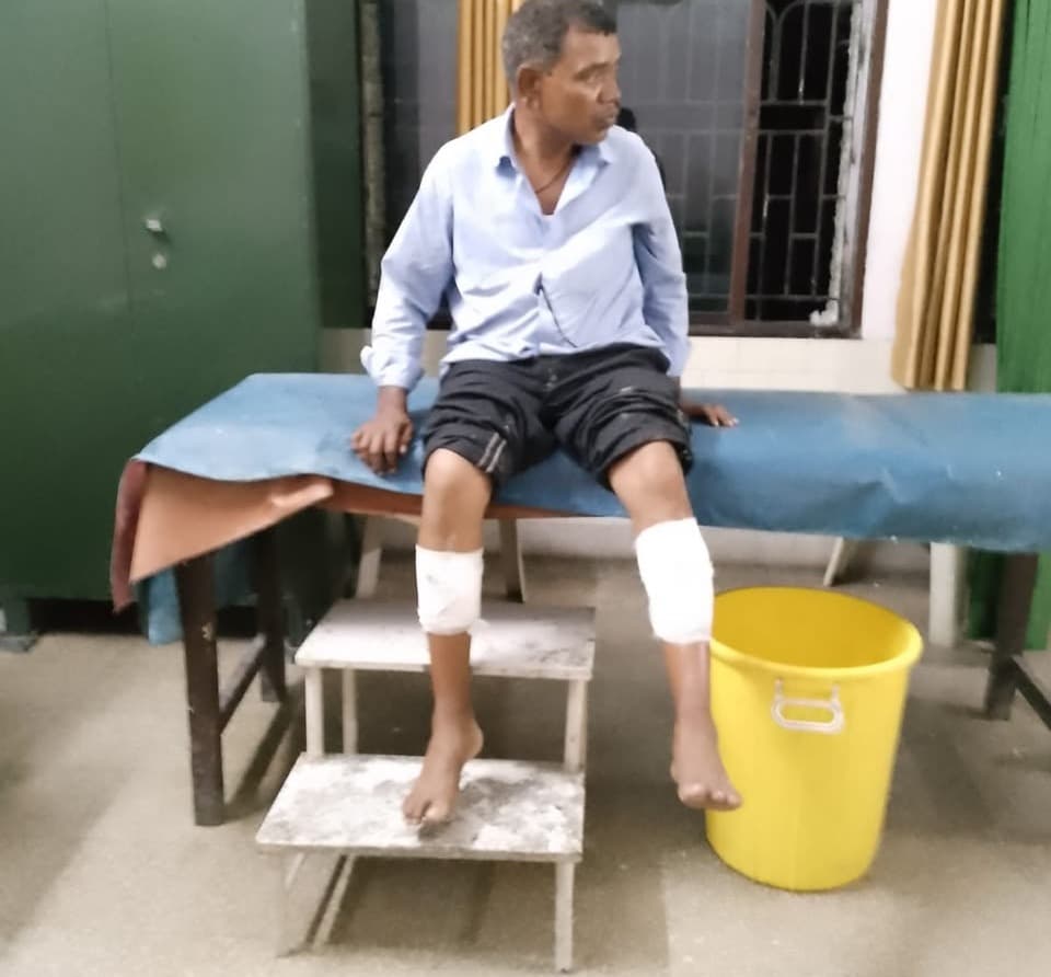 सीसीएल झारखंड उत्खनन परियोजना खदान में ब्लास्टिंग, मजदूर घायल