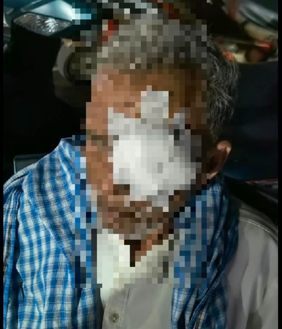 पेड़ काटने को लेकर उपजा विवाद , वृद्ध के साथ हुई मारपीट