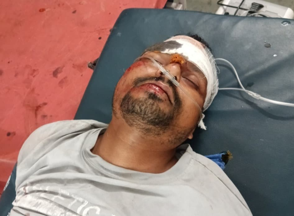 सड़क हादसे में युवक घायल, सदर अस्पताल रेफर 