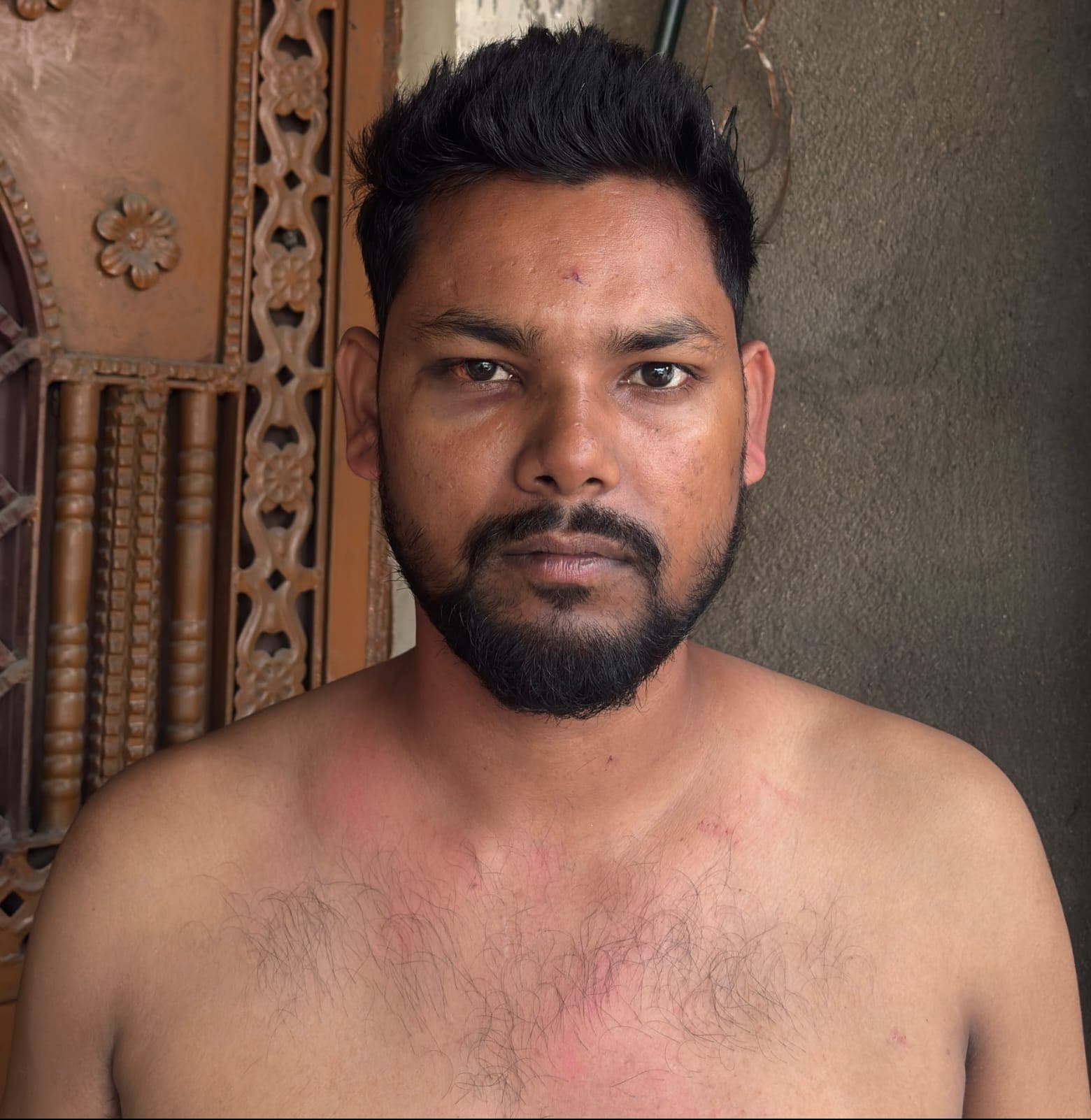मारपीट में घायल युवक ने थाना में दिया आवेदन, जान से मारने की धमकी देने का आरोप