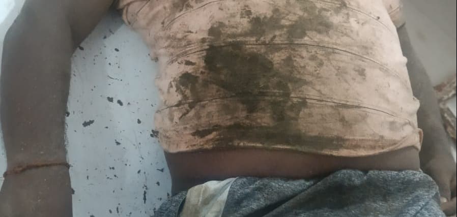 चौपारण के ब्रह्मोरिया में करंट लगने से एक की मौत, चार घायल